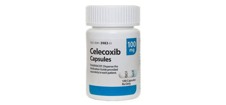 order cheaper celecoxib online in Sigurd, UT