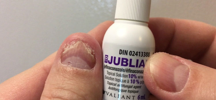 order cheaper jublia online in Alpine, UT